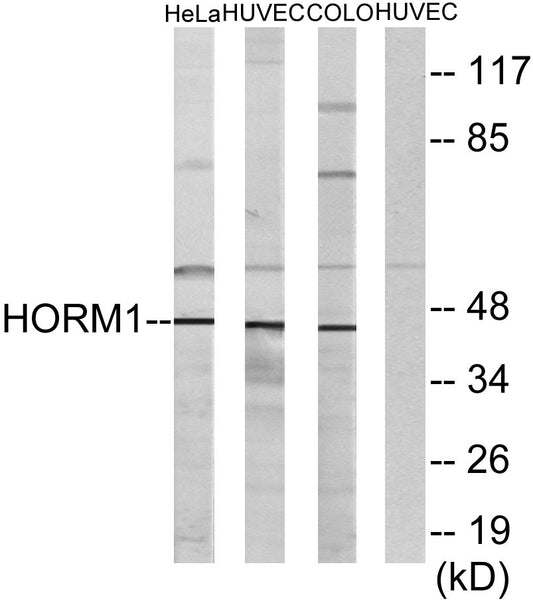 HORMAD1 Rabbit Polyclonal Antibody