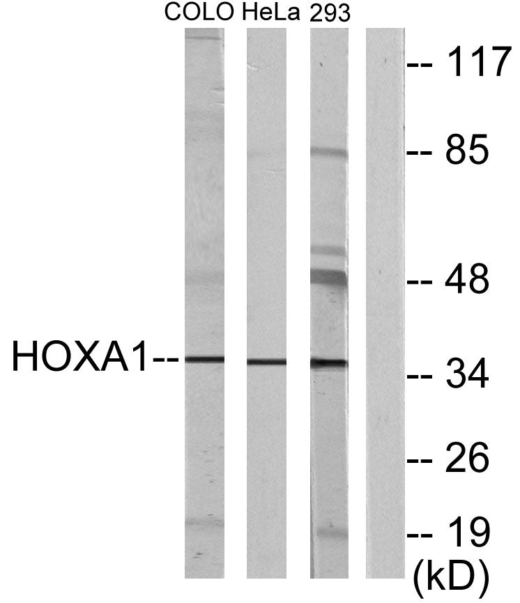 Hox-A1 Rabbit Polyclonal Antibody