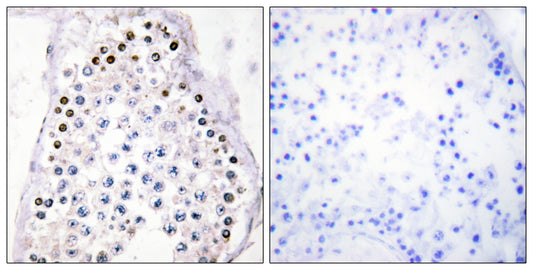 Hox-A1/B1/D1 Rabbit Polyclonal Antibody