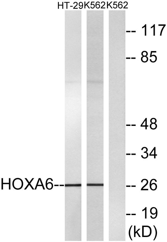 HoxA6 Rabbit Polyclonal Antibody