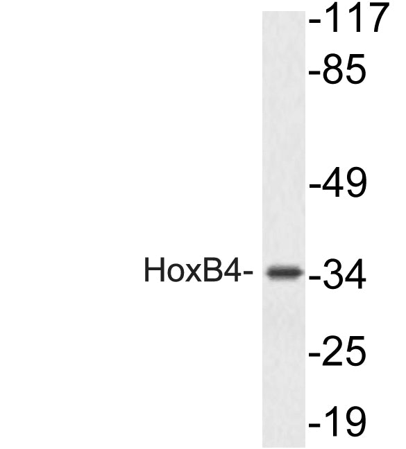 HoxB4 Rabbit Polyclonal Antibody
