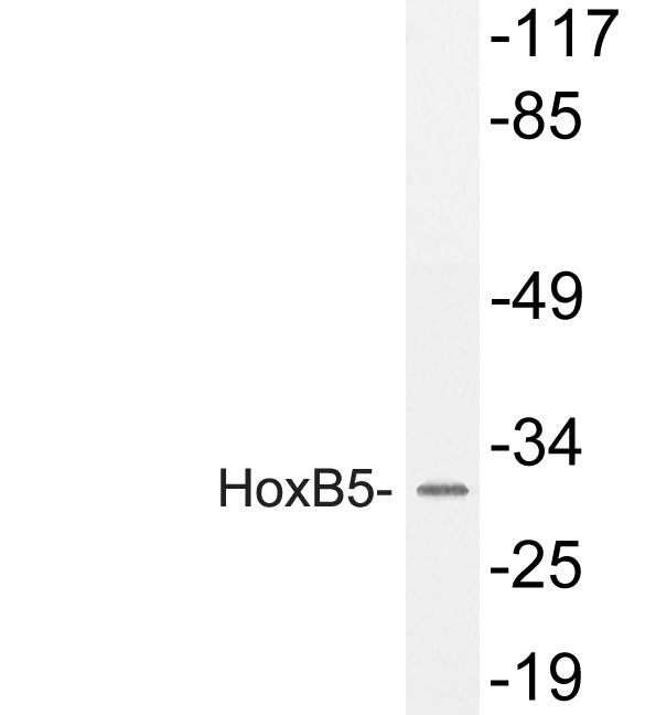 HoxB5 Rabbit Polyclonal Antibody