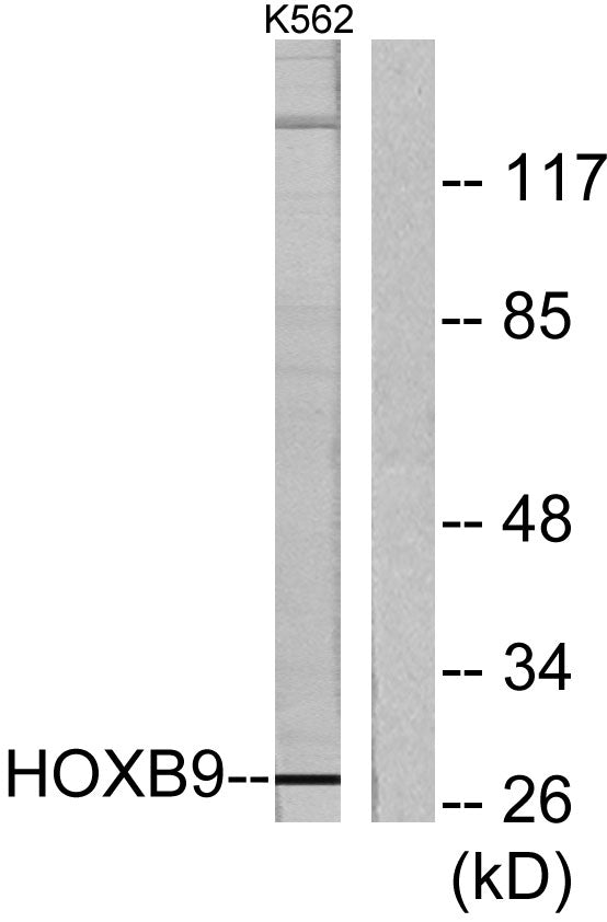 Hox-B9 Rabbit Polyclonal Antibody