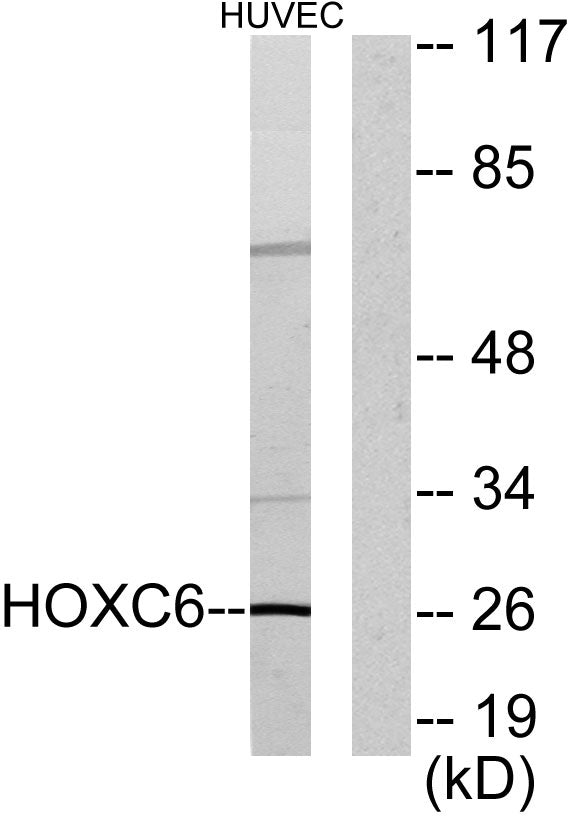 Hox-C6 Rabbit Polyclonal Antibody