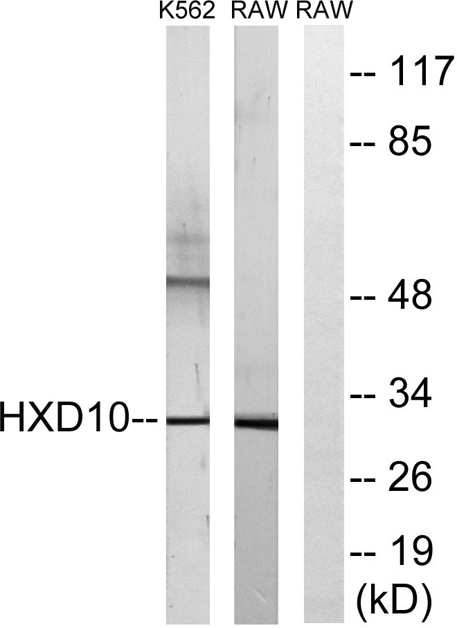 HoxD10 Rabbit Polyclonal Antibody