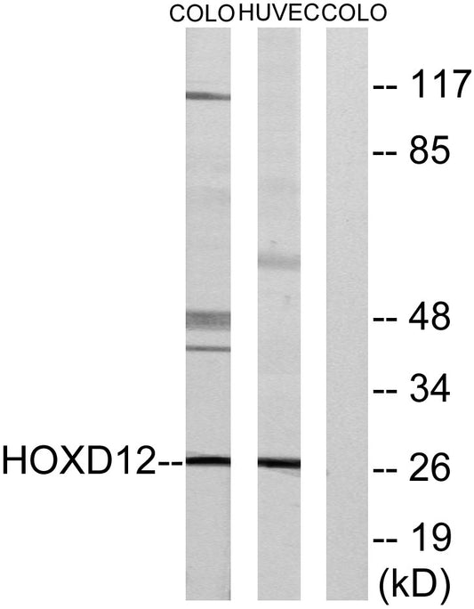 HoxD12 Rabbit Polyclonal Antibody