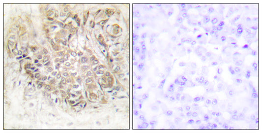 HRF Rabbit Polyclonal Antibody