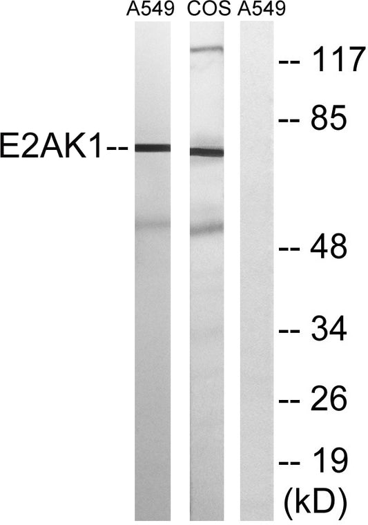 HRI Rabbit Polyclonal Antibody