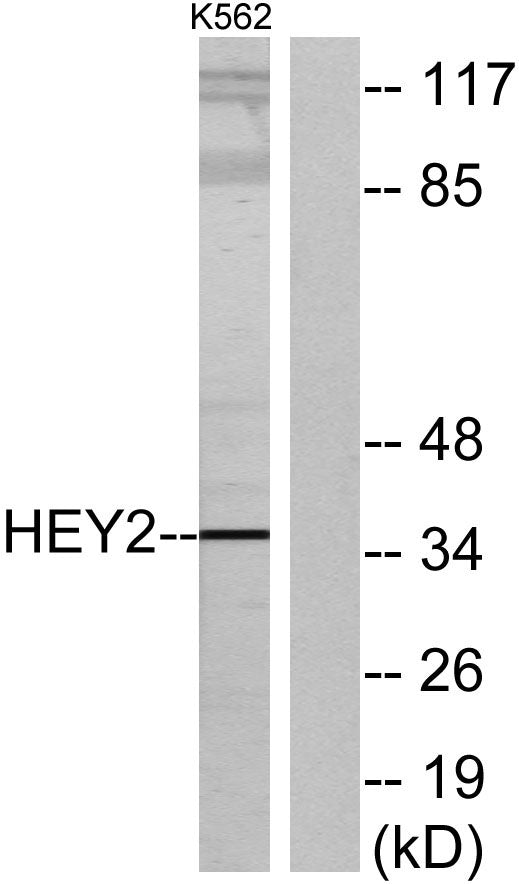 HRT2 Rabbit Polyclonal Antibody