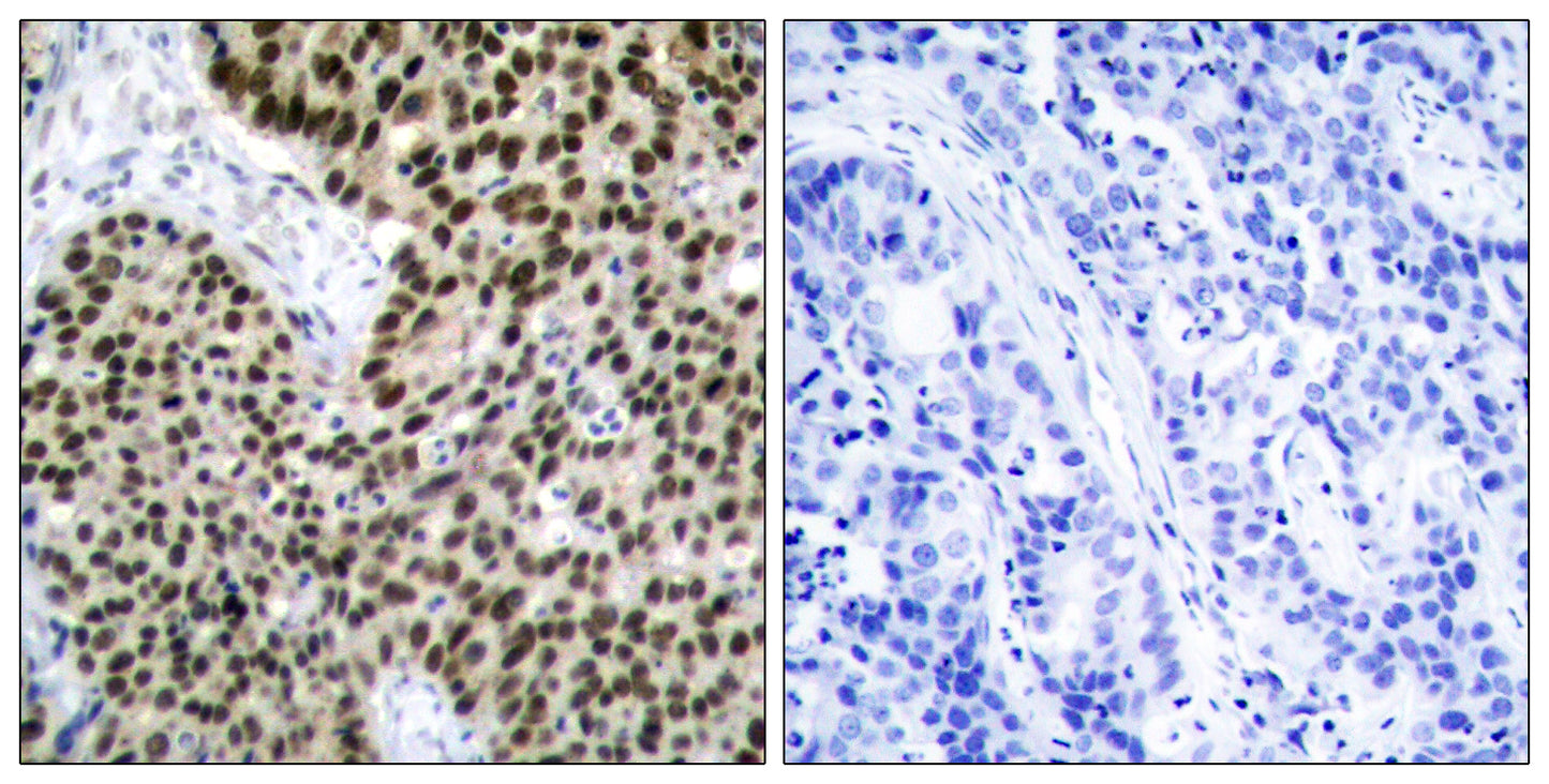 HSF1 Rabbit Polyclonal Antibody