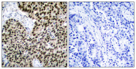 HSF1 Rabbit Polyclonal Antibody