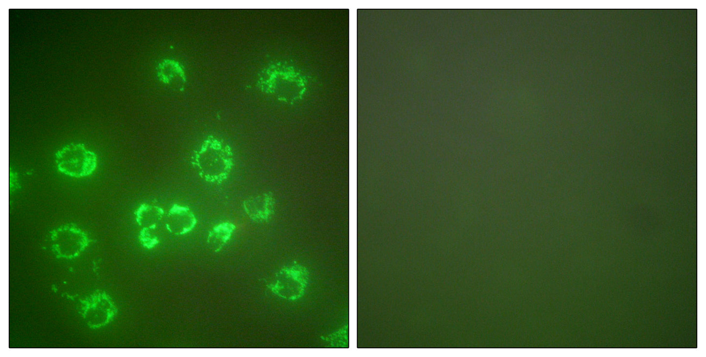 HSP A9 Rabbit Polyclonal Antibody