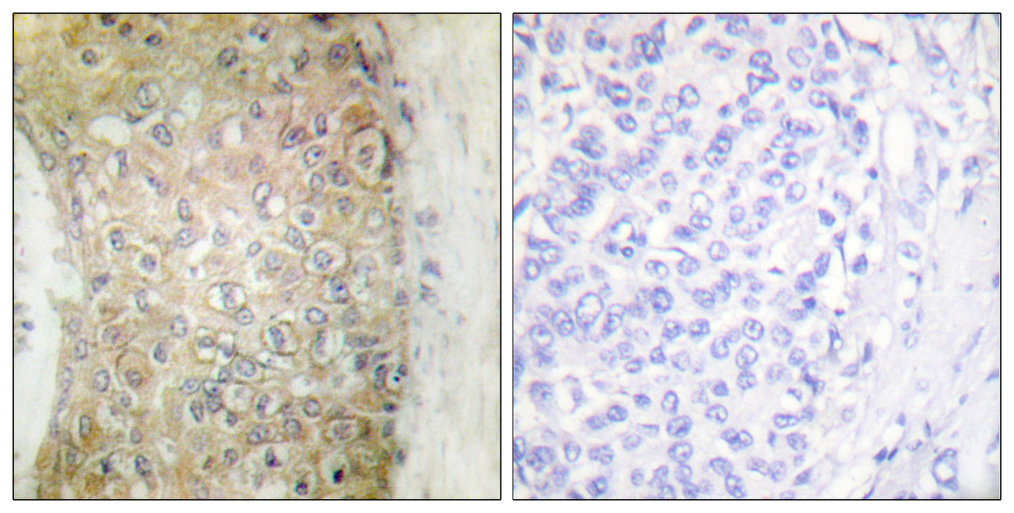 HSP20 Rabbit Polyclonal Antibody