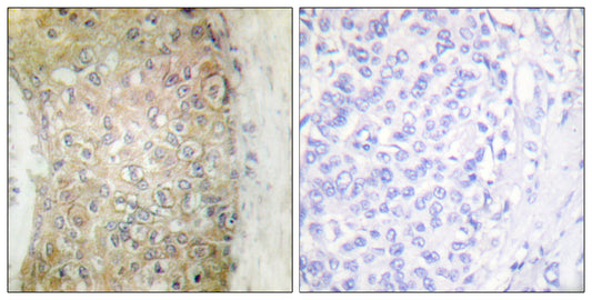 HSP20 Rabbit Polyclonal Antibody