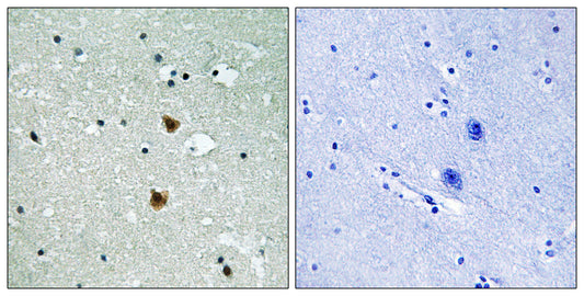 HSP27 Rabbit Polyclonal Antibody