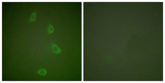 HSP40 Rabbit Polyclonal Antibody