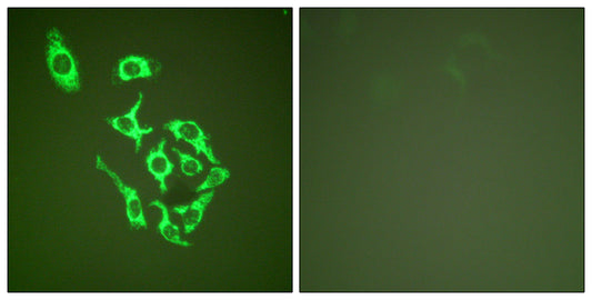 HSP60 Rabbit Polyclonal Antibody