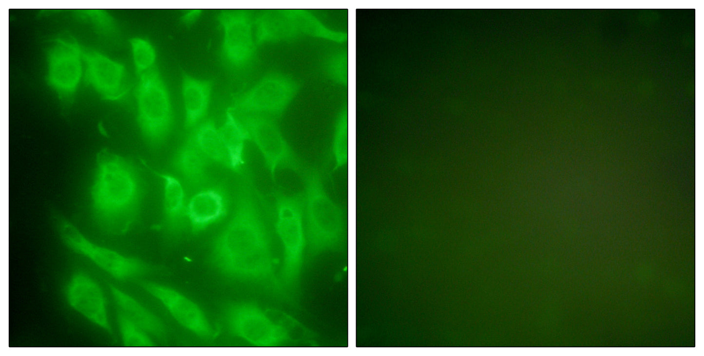 HSP90A Rabbit Polyclonal Antibody