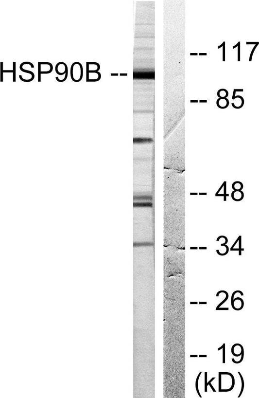 HSP90β Rabbit Polyclonal Antibody
