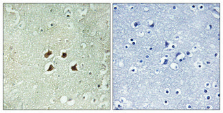 Huntingtin Rabbit Polyclonal Antibody