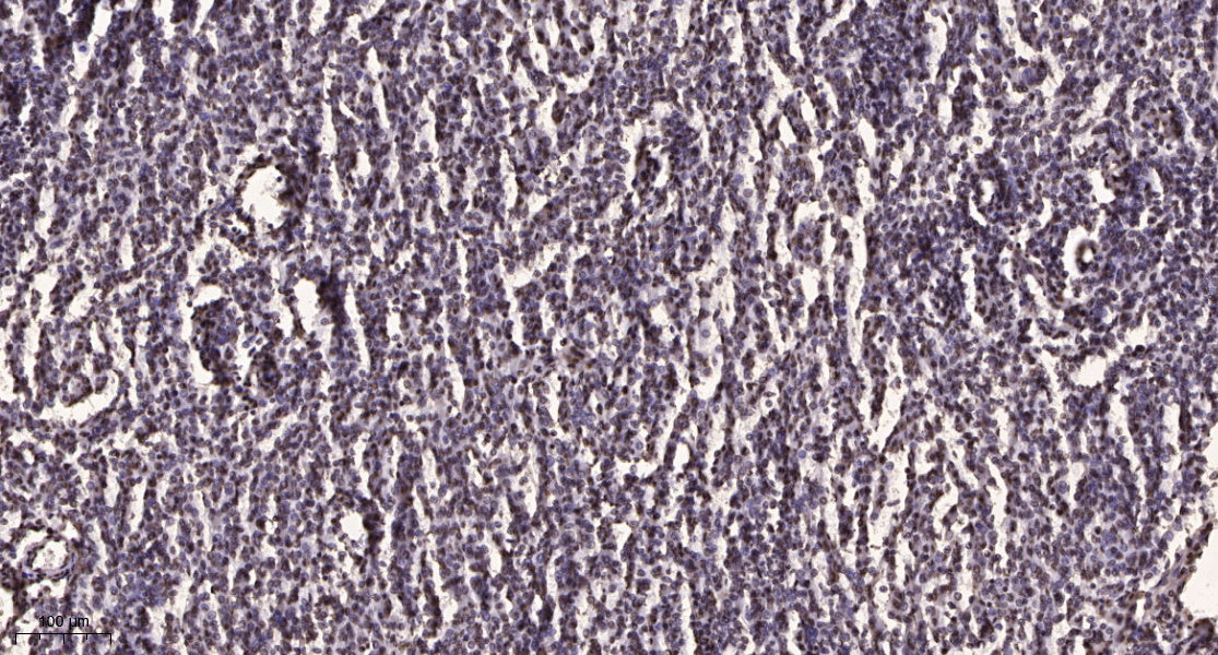 HUWE1 Rabbit Polyclonal Antibody