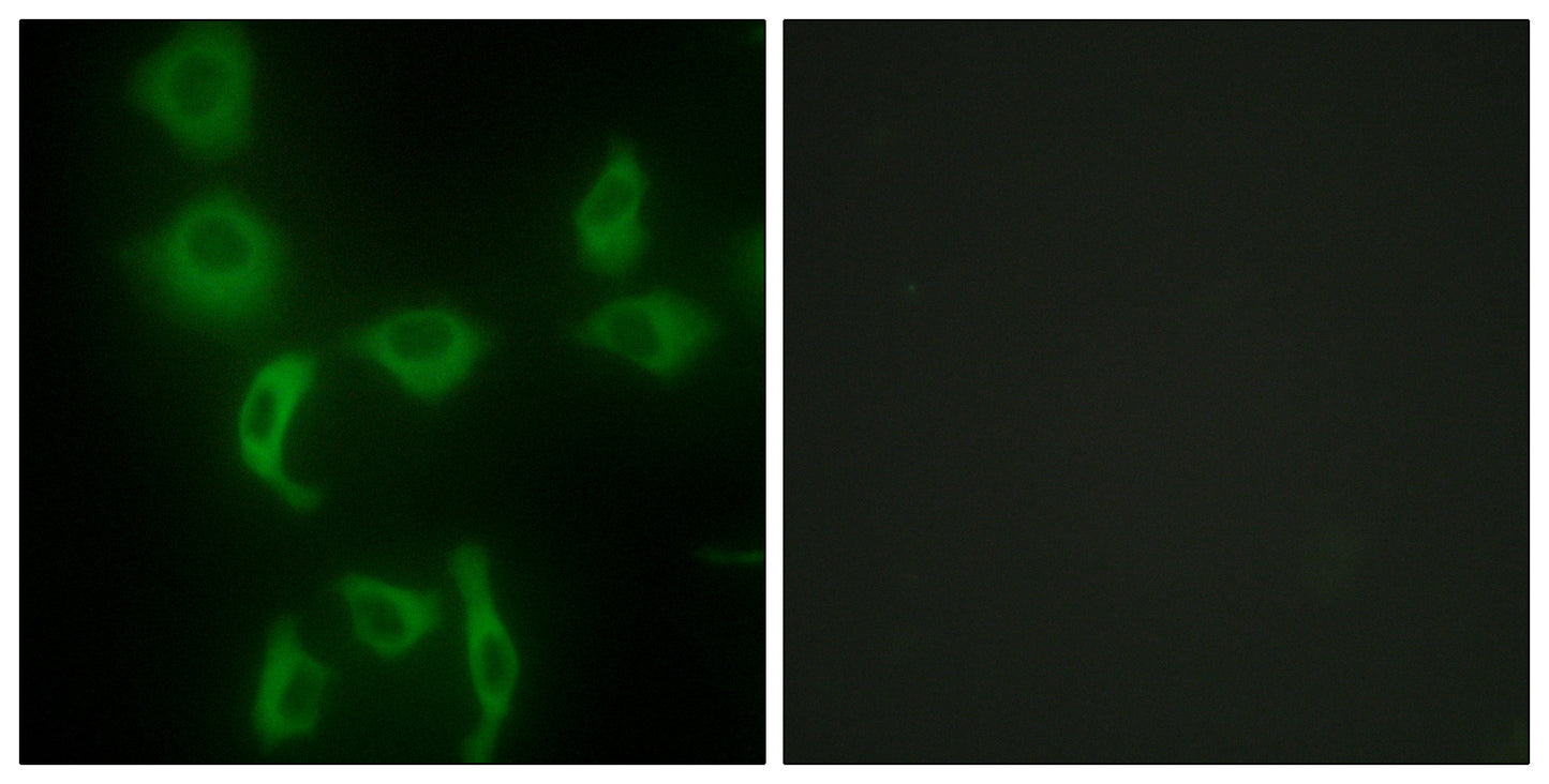 IARS2 Rabbit Polyclonal Antibody