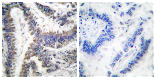 ICAD Rabbit Polyclonal Antibody