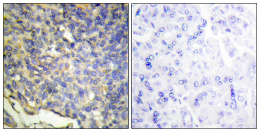 ICAD Rabbit Polyclonal Antibody