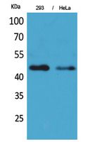 IDH1 Rabbit Polyclonal Antibody