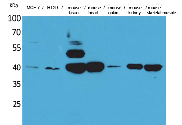 IDH3A Rabbit Polyclonal Antibody