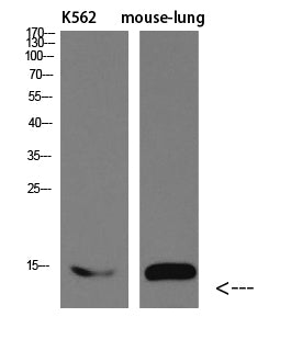 I-FABP Rabbit Polyclonal Antibody