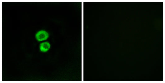 IFITM3 Rabbit Polyclonal Antibody