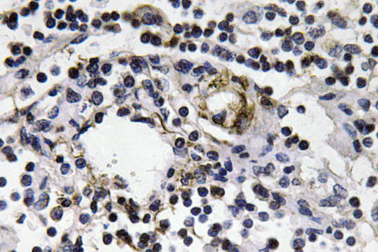IFN-γ Rabbit Polyclonal Antibody