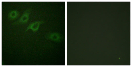 IFN-γRα Rabbit Polyclonal Antibody