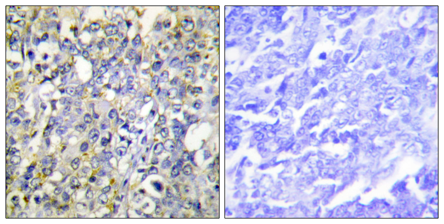 IGFBP3 Rabbit Polyclonal Antibody