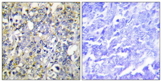 IGFBP3 Rabbit Polyclonal Antibody
