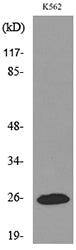 IGFBP6 Rabbit Polyclonal Antibody