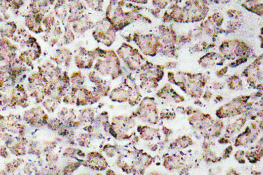 IGF-I Rabbit Polyclonal Antibody