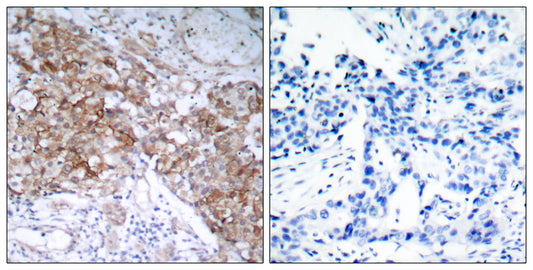 IGF-IR Rabbit Polyclonal Antibody