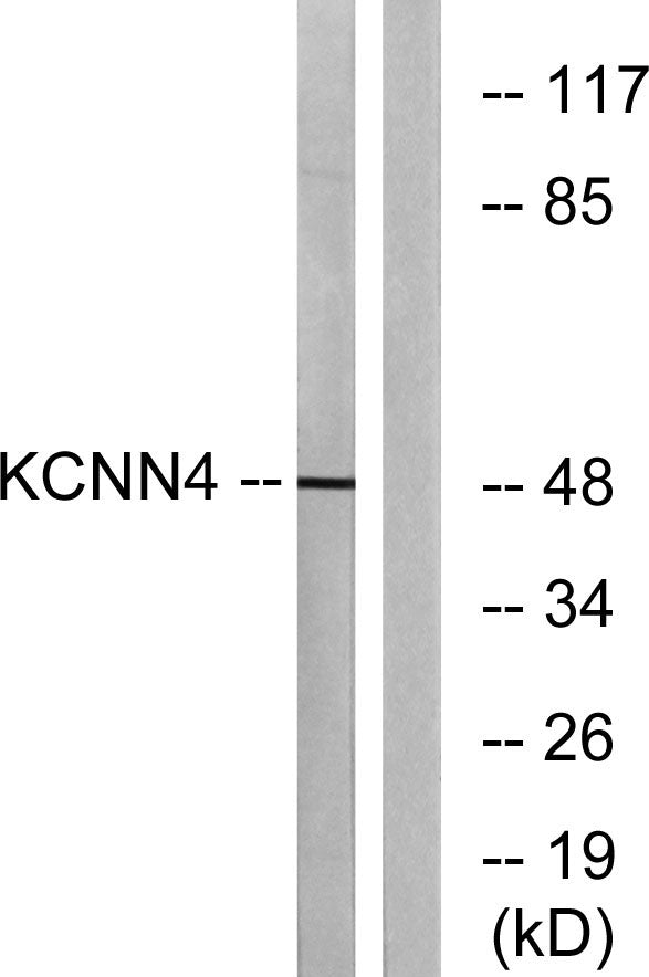 IK1 Rabbit Polyclonal Antibody