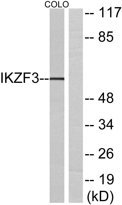 Ikaros 3 Rabbit Polyclonal Antibody