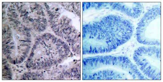 IKKα Rabbit Polyclonal Antibody