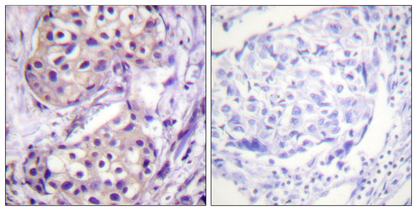 IKKβ Rabbit Polyclonal Antibody