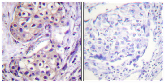 IKKβ Rabbit Polyclonal Antibody