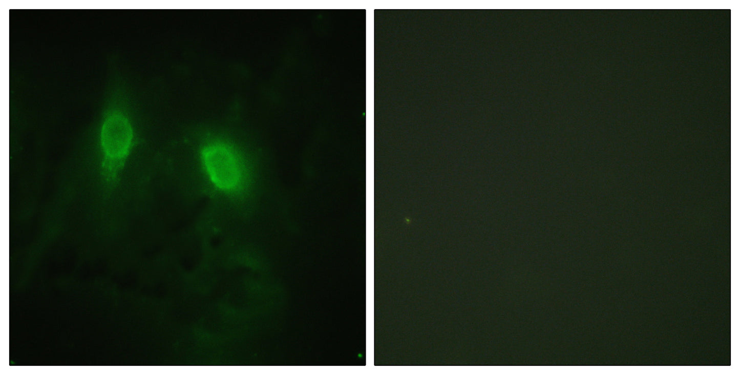 IKKγ Rabbit Polyclonal Antibody