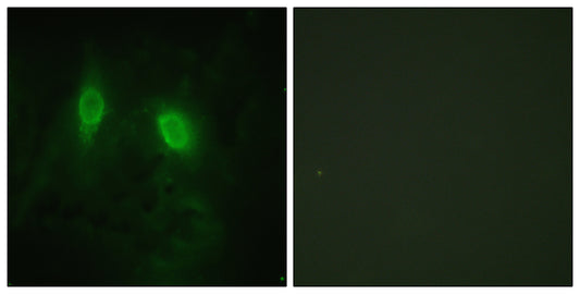 IKKγ Rabbit Polyclonal Antibody