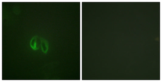 IL-10Rα Rabbit Polyclonal Antibody