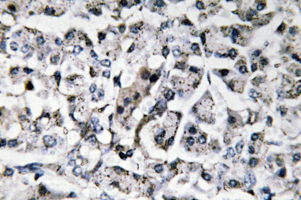 IL-11 Rabbit Polyclonal Antibody