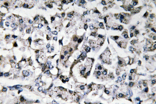 IL-11 Rabbit Polyclonal Antibody