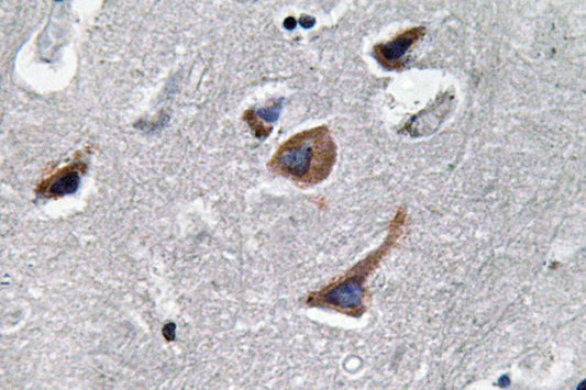 IL-12A Rabbit Polyclonal Antibody